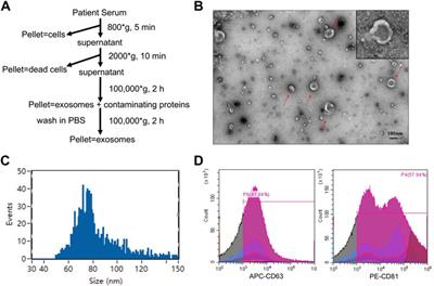 Serum extracellular vesicle MicroRNAs as candidate biomarkers for acute rejection in patients subjected to liver transplant